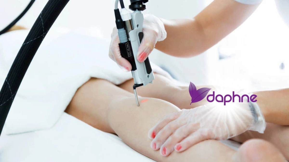Alexandrite Laser Hair Removal