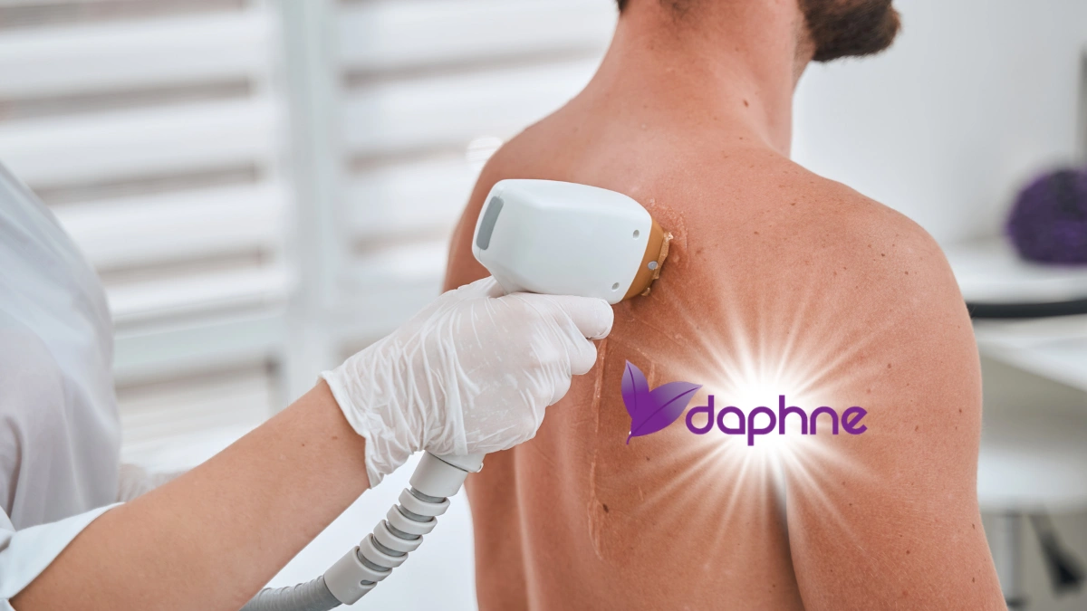 Laser Hair Removal for Men