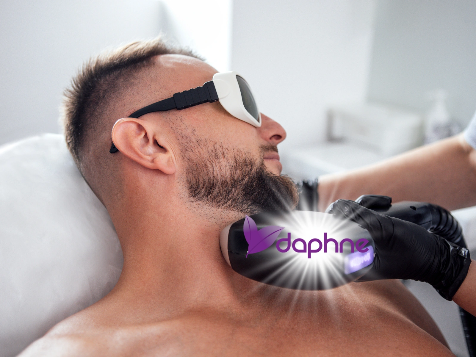 Neck and nape laser hair removal treatment