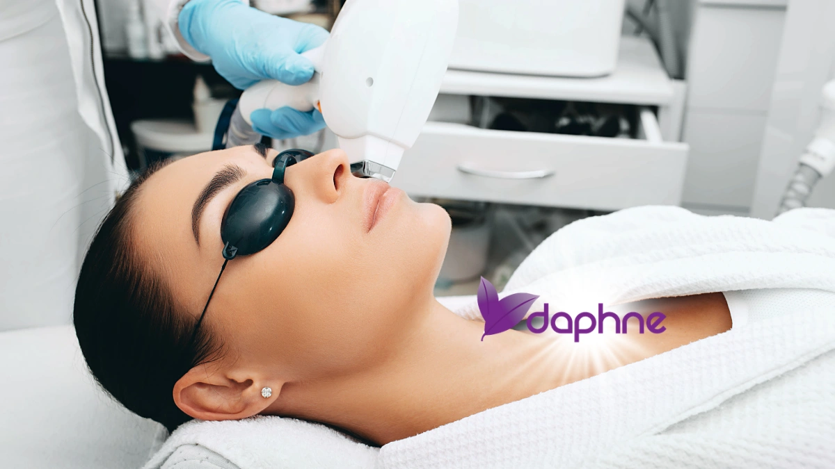 Upper Lip Chin Laser Hair Removal